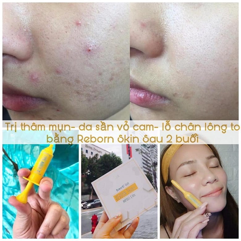 Bevita.vn