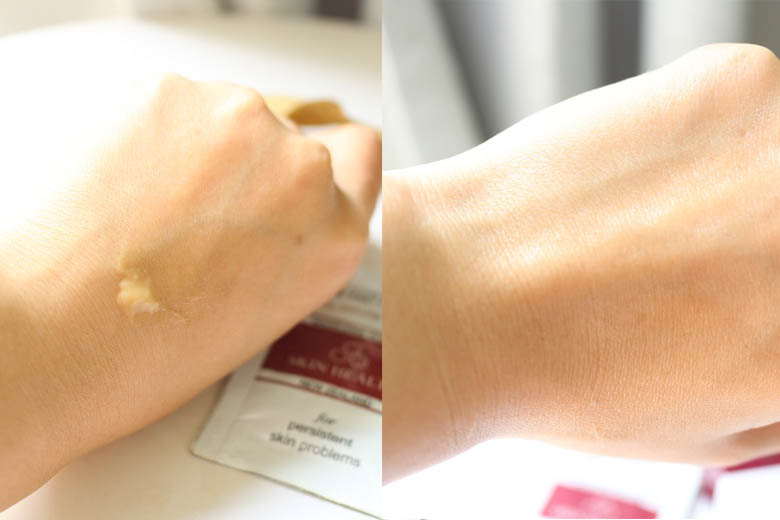 Trước và sau khi sử dụng kem mật ong Manuka 16+